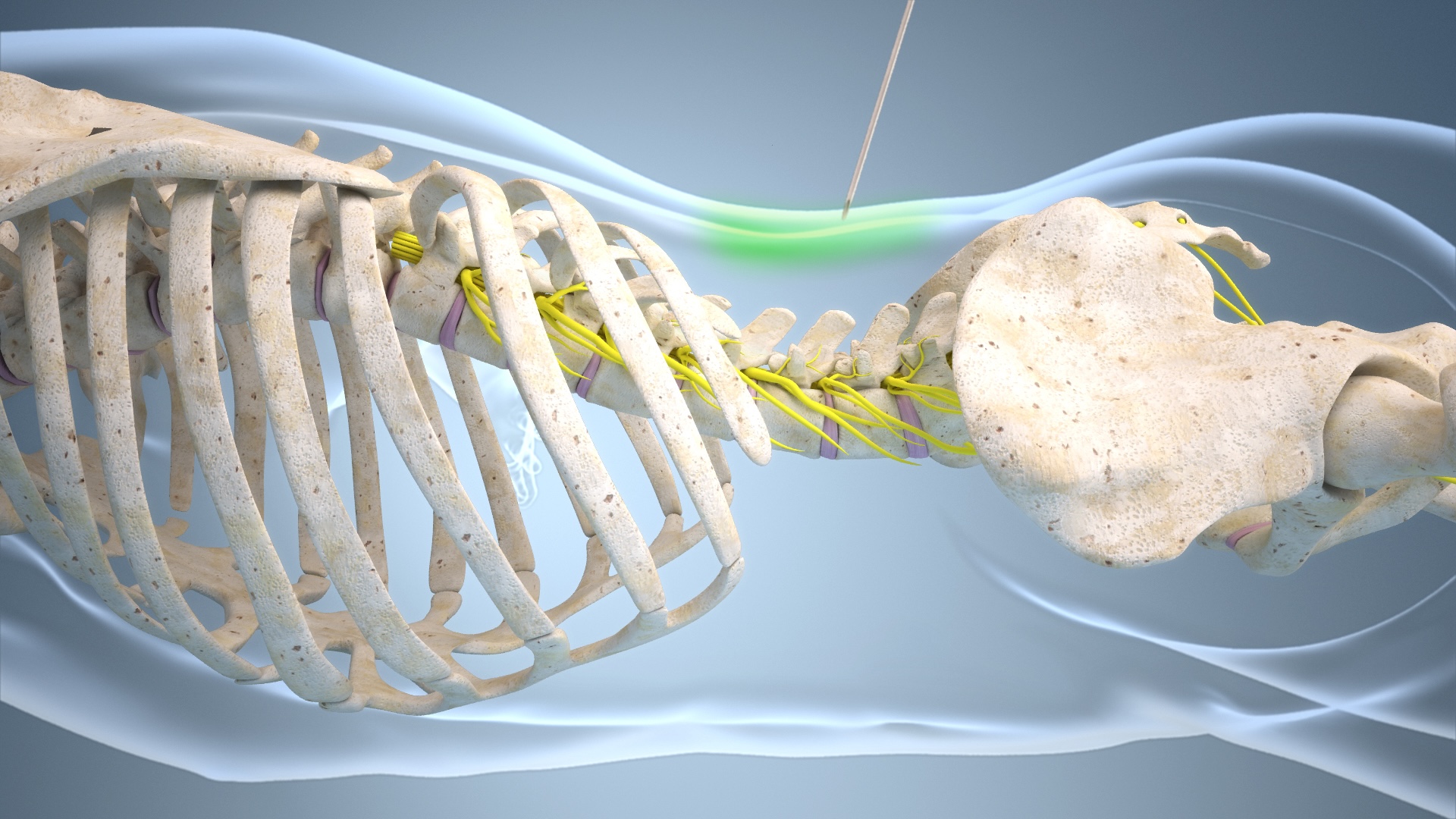 Precizní diagnostika léčby bolesti